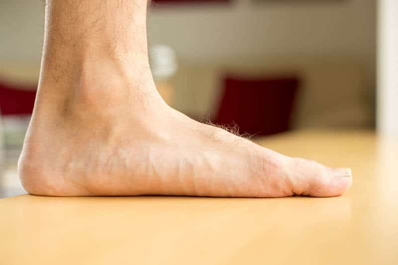Man with flat foot